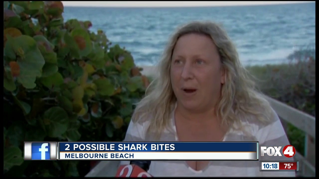 Shark Bites at Melbourne Beach Florida