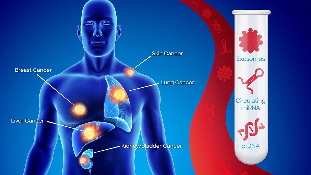 Baylor Scott & White Health Texas Immuno-Oncology Biorepository (TIOB)