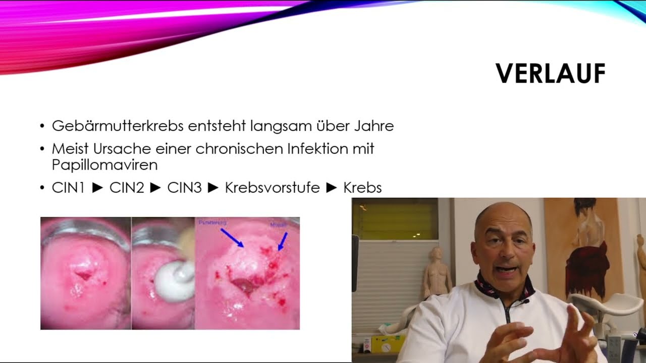 Gynäkologische Dysplasie und Krebsvorsorge - Robinson Frauenmedizin