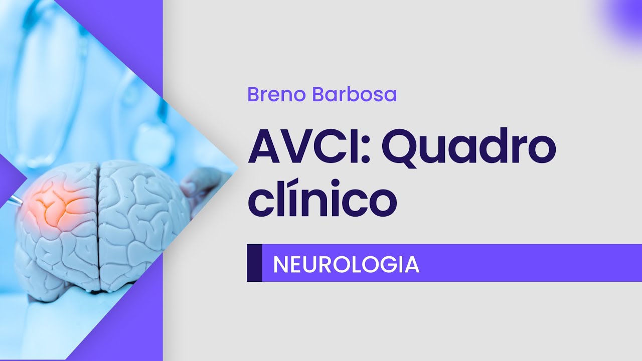 AVCI: Quadro clínico | Cortes de aula: Medclub PRIME - Neurologia