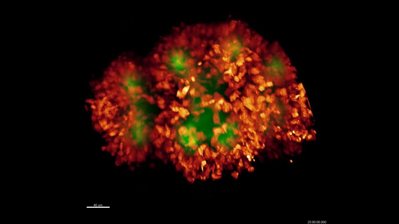 Nephron progenitor cells condense around the ureteric buds in the developing mouse kidney