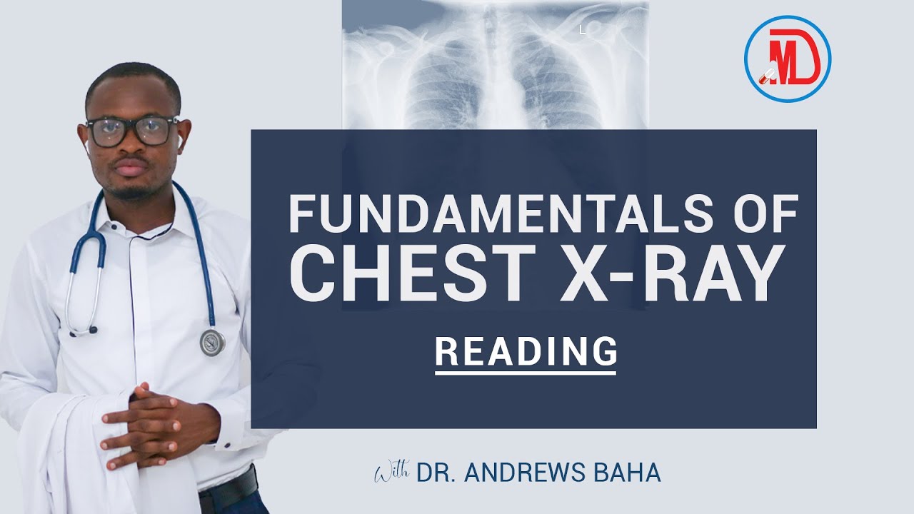 GMDC || FUNDAMENTALS OF CHEST X-RAY READING
