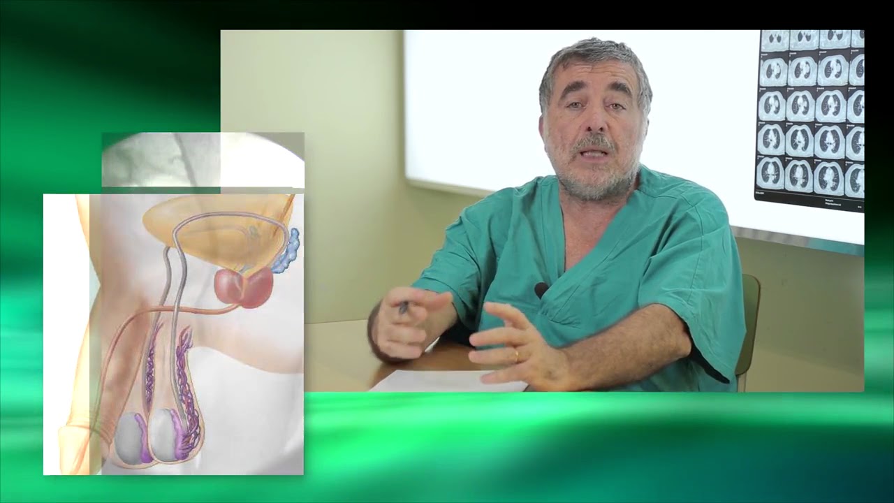 Radiologia Interventistica e trattamento dei Varicocele Maschile