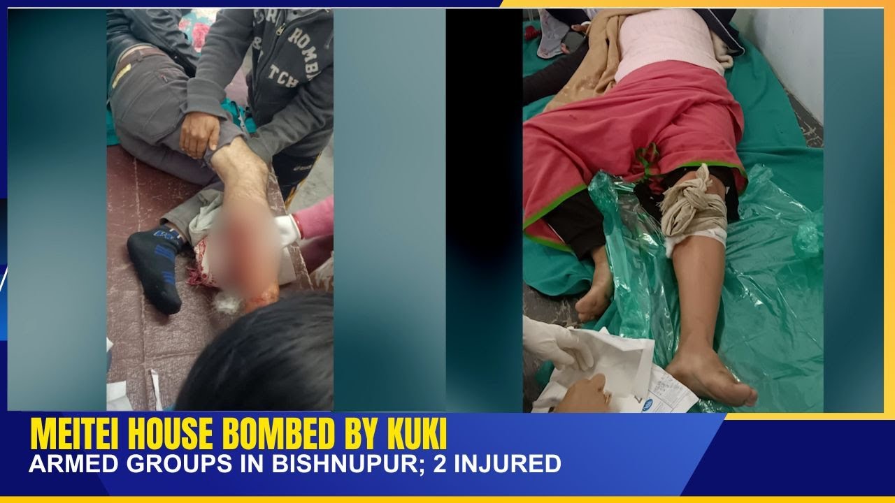 MEITEI HOUSE BOMBED BY KUKI ARMED GROUPS IN BISHNUPUR; 2 INJURED   | 05 JAN 2026
