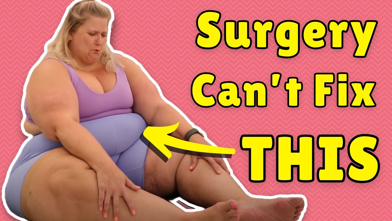 600 lbs ‘Because of Genetics’ – Latest Excuses (and Delusions) from Anna