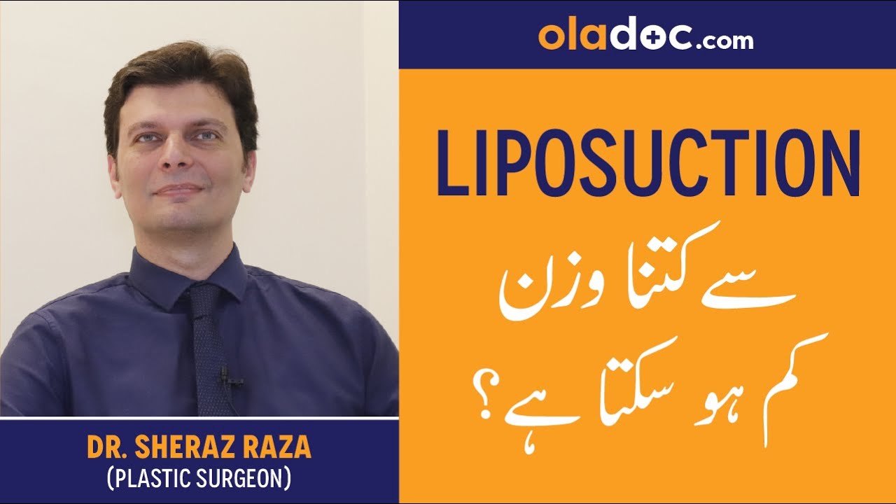 How Much Weight You Can Lose with Liposuction Sa Kitna Wazan Kam Kea Ja Sakta hai|Urdu Hindi|