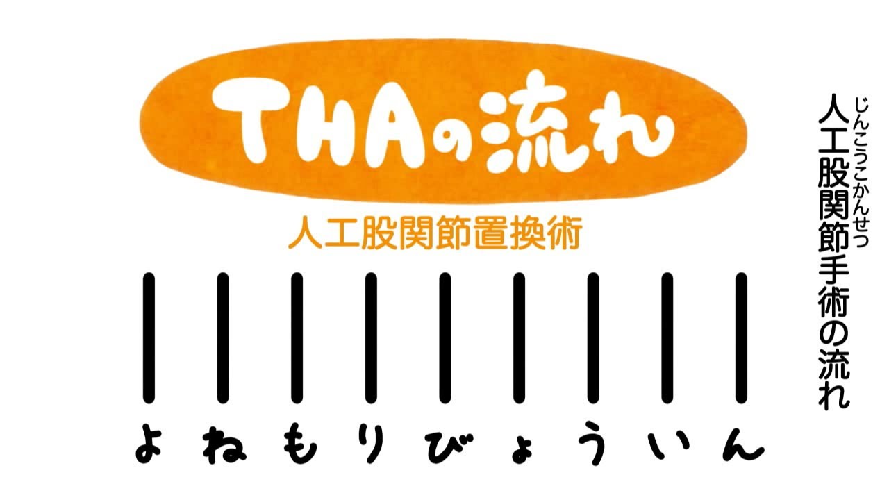 人工股関節置換手術（THA）の流れ