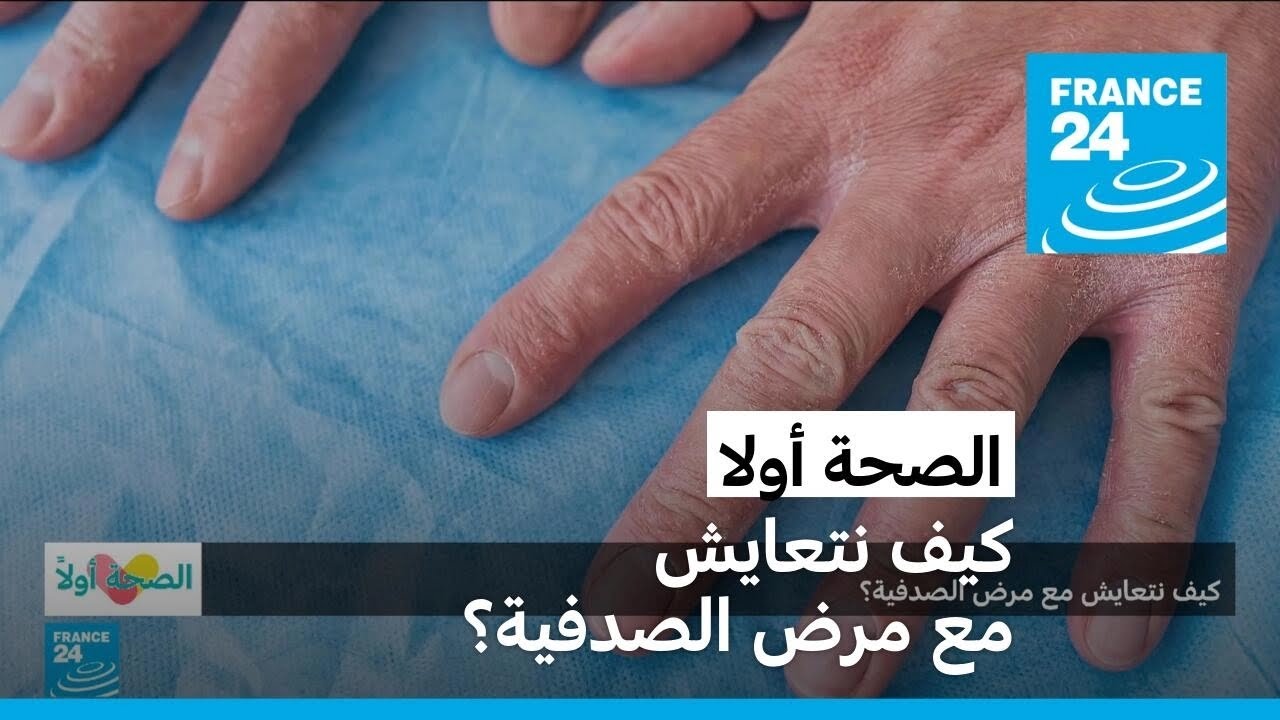 كيف نتعايش مع مرض الصدفية؟ • فرانس 24 / FRANCE 24