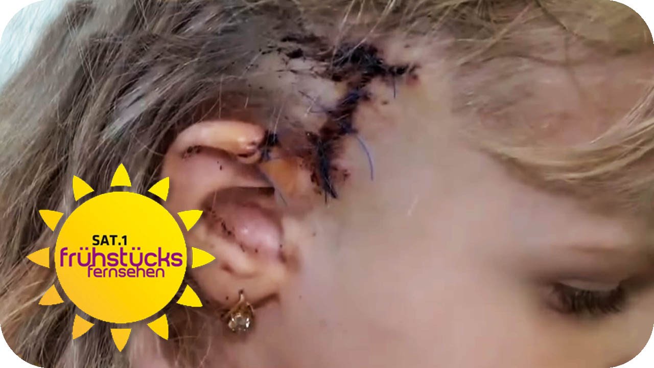 Biker fährt 3-JÄHRIGE um | SAT.1 Frühstücksfernsehen