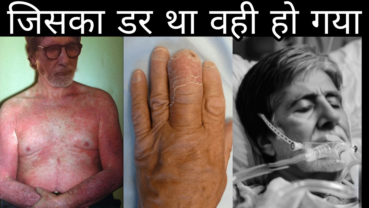 Amitabh Bachchan Health Latest Update Today After Hospitalization #amitabhbachchan