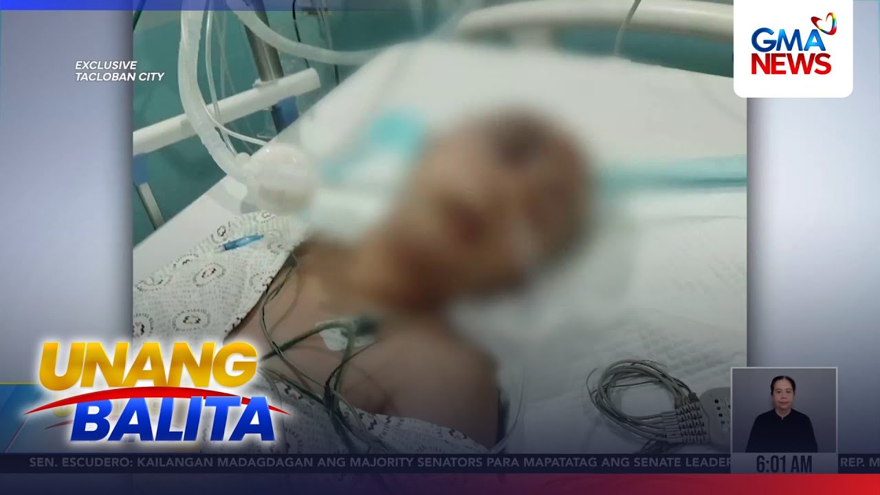 2 estudyante, nananatili sa ICU matapos mapuruhan sa Tacloban school shooting | Unang Hirit
