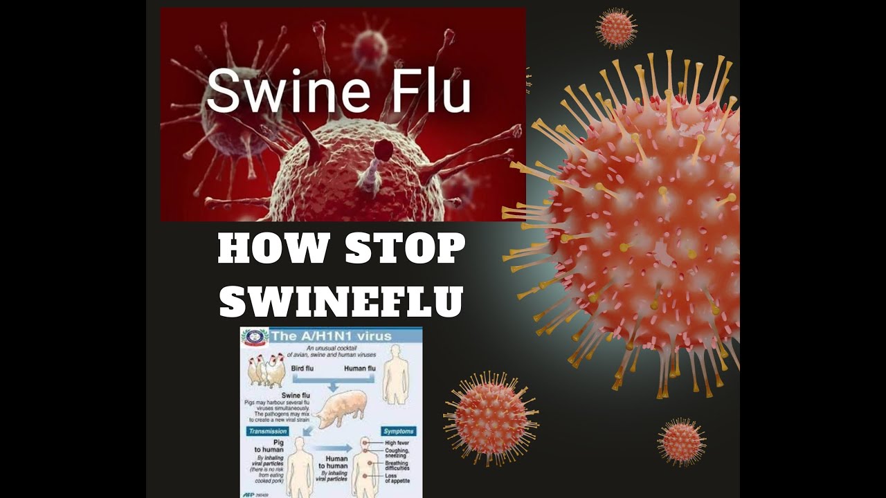 What Exactly is H1N1 | Swine Flu Virus Symptoms, Diagnoses and Prevention