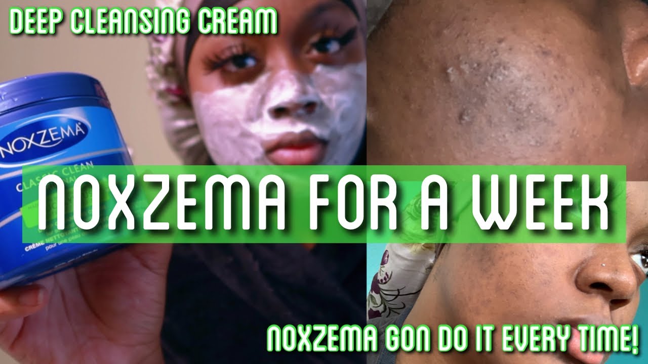 NOXZEMA | NOXZEMA DEEP CLEANSING CLEAN | USING NOXZEMA FOR A WEEK