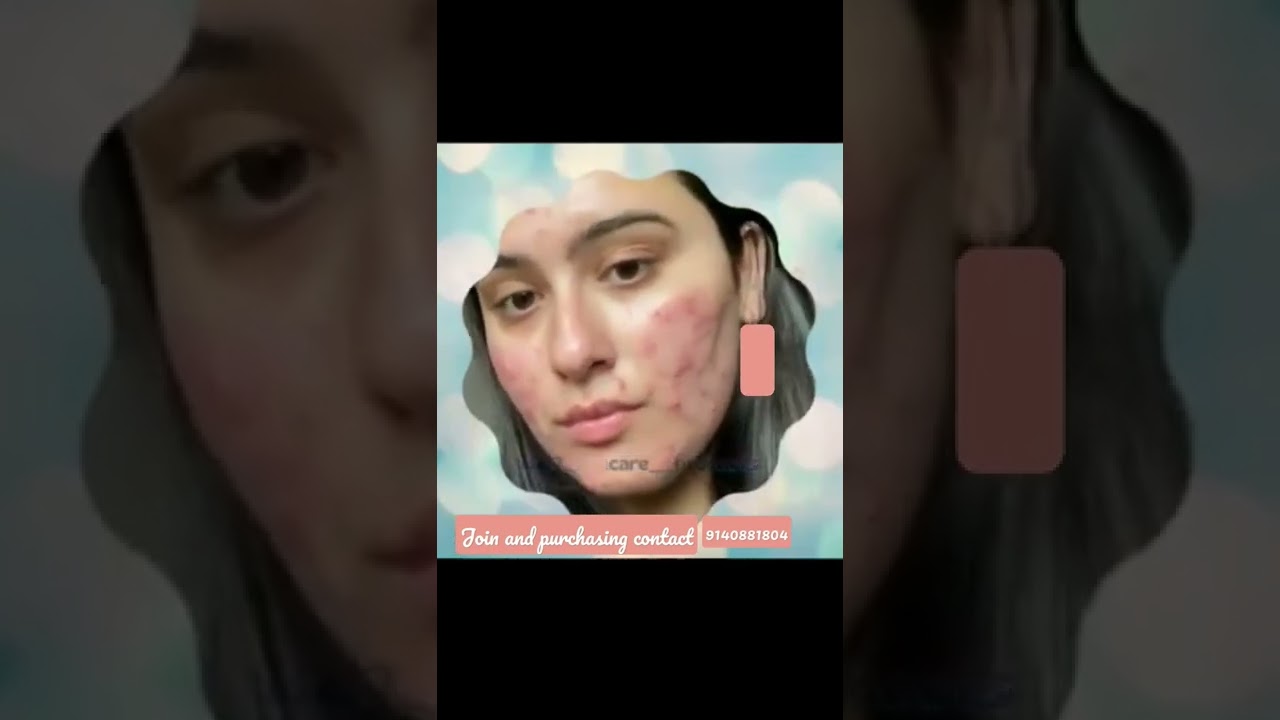 modi care skin treatment