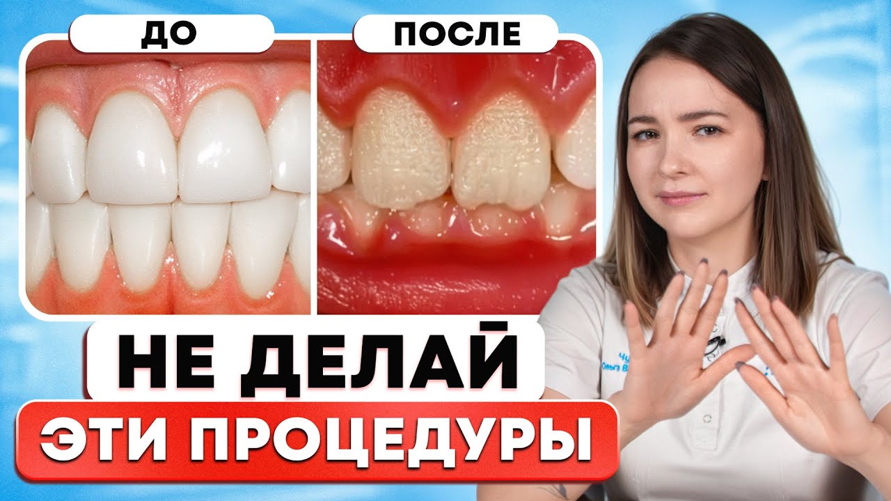 6 самых БЕСПОЛЕЗНЫХ ПРОЦЕДУР в стоматологии!