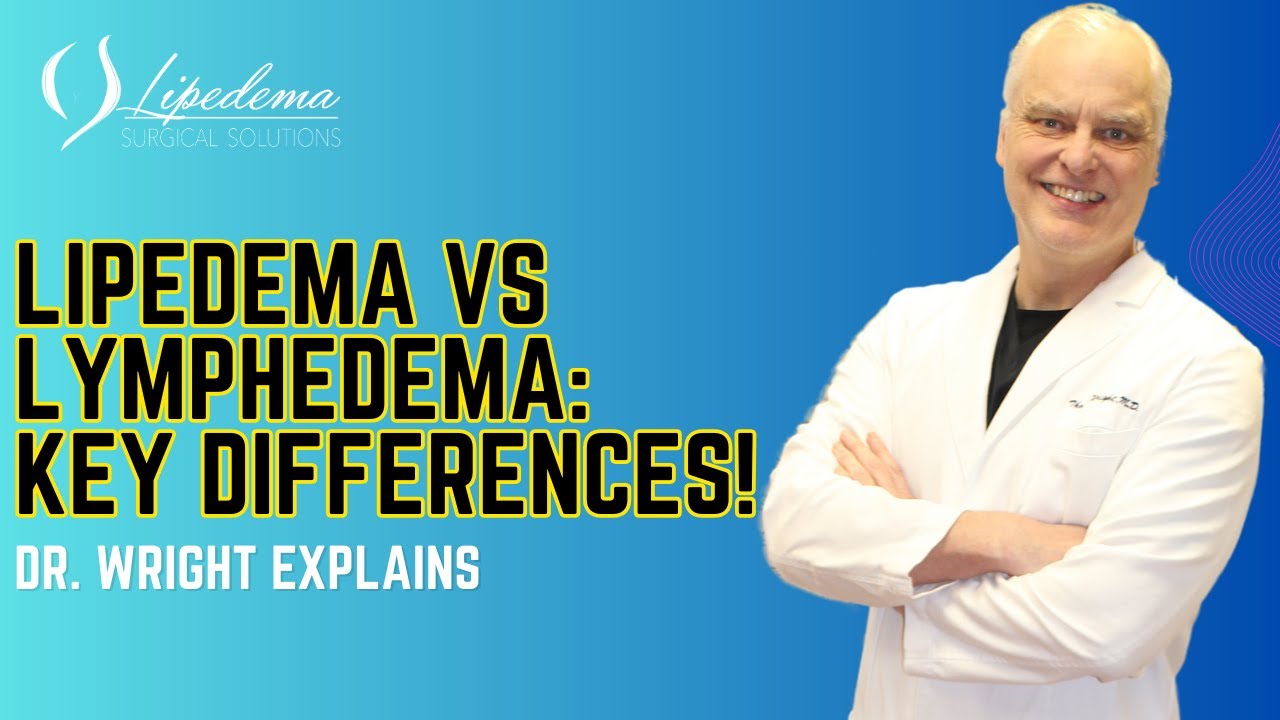 Lipedema vs Lymphedema: Key Differences, Causes, and Treatments Explained