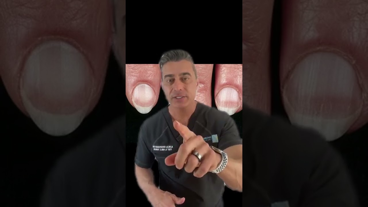 Todo lo que necesitas saber sobre las u&ntilde;as p&aacute;lidas