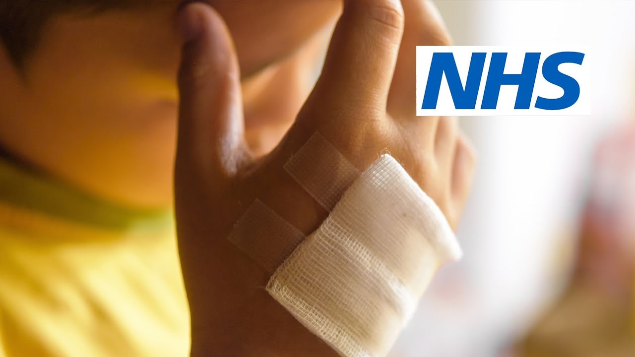 How do I deal with burns and scalds? (9 to 30 months) | NHS