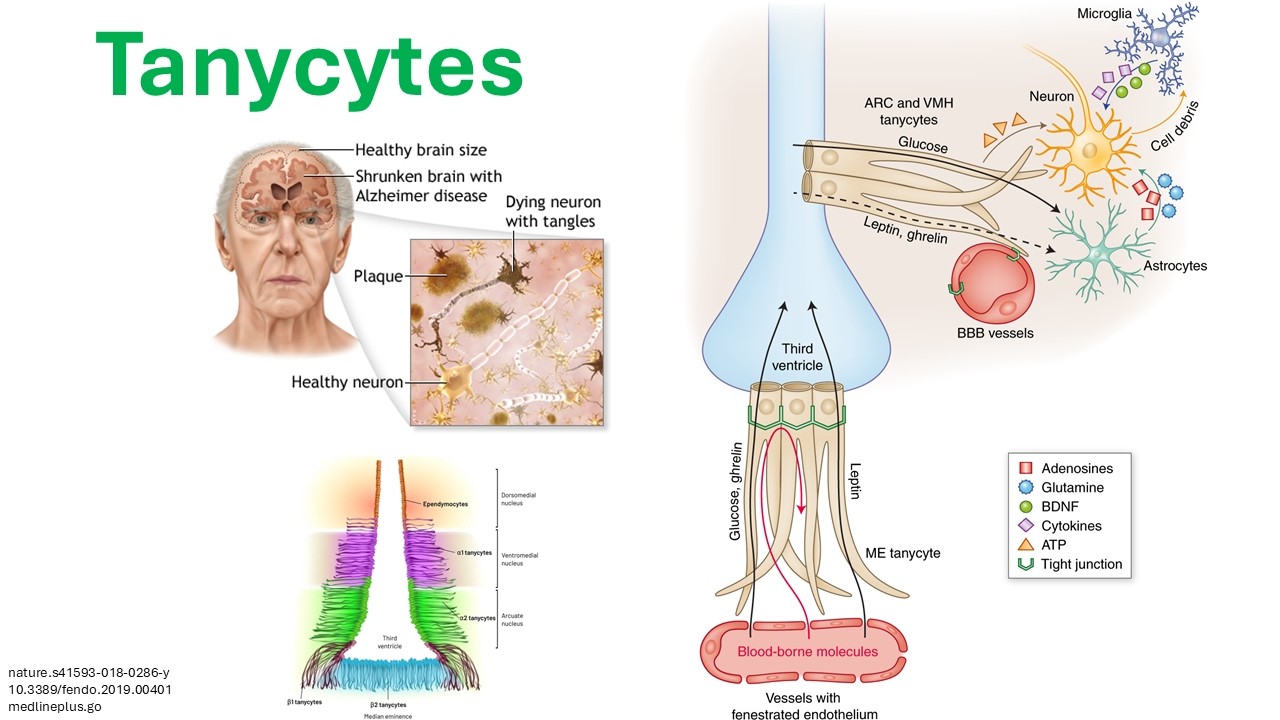 New Discovery in Alzheimer’s Disease: The Role of Tanycytes