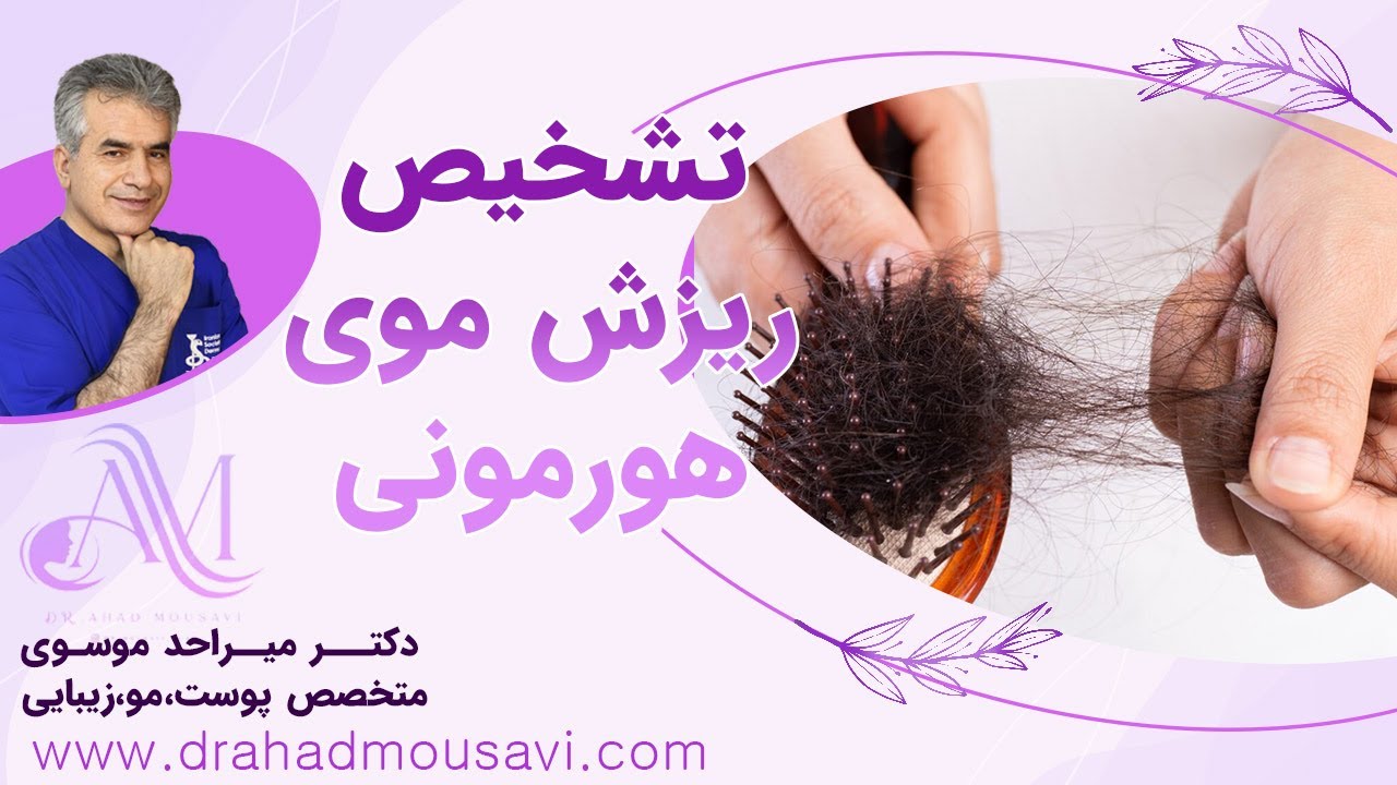 درمان قطعی ریزش موی هورمونی به این نحو