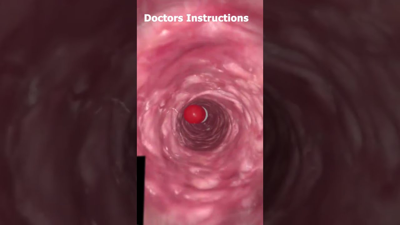 How To CAPSULE 💊 Metabolize in Stomach💊🩸 #animation #1million #3d
