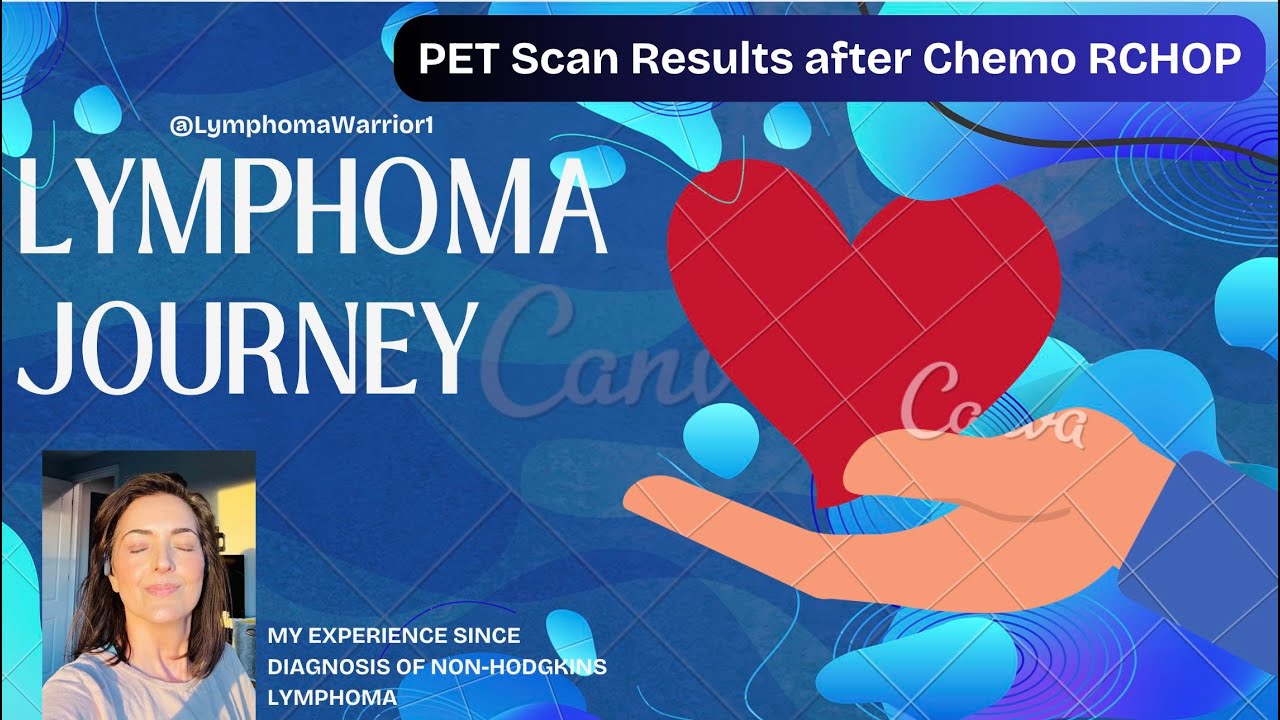 PET scan results- Lymphoma