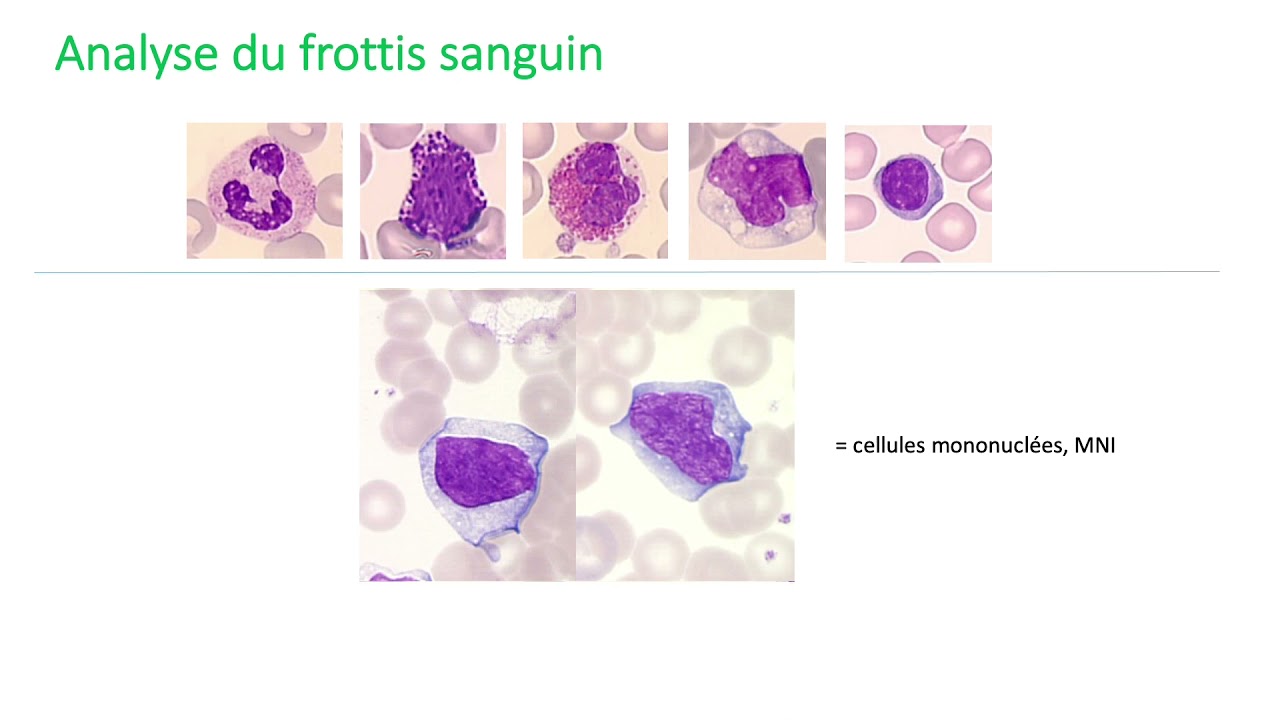 Les outils diagnostics en hématologie
