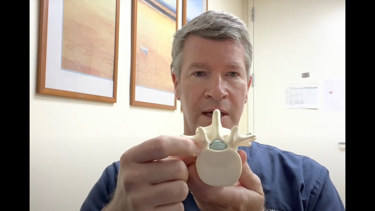 LSS: What are the available treatments for spinal stenosis in 2023? Open surgery VS MIS for pain.