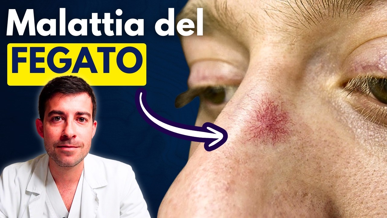 8 Segnali del Fegato Malato