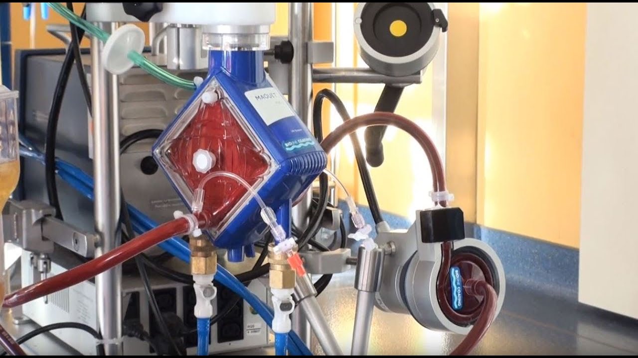 Wach-ECMO: Bessere Überlebenschancen für Schwerstkranke