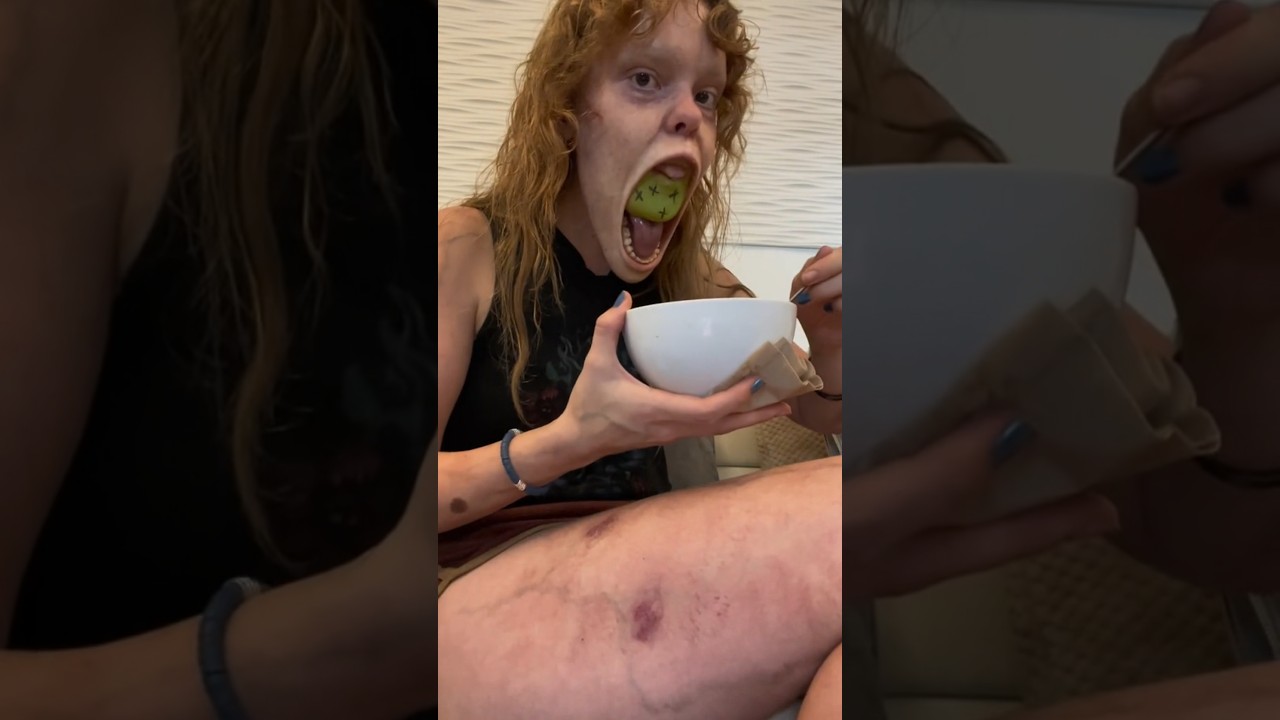 Mais um dia normal, um ZUMBI foi se Consultar com Dentista!! #shorts