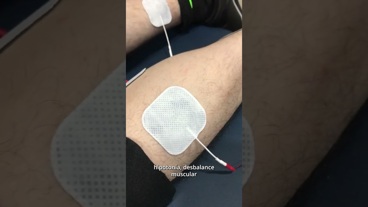 Corrientes EMS con Twin Stim Plus | #TerritorioFisiolab