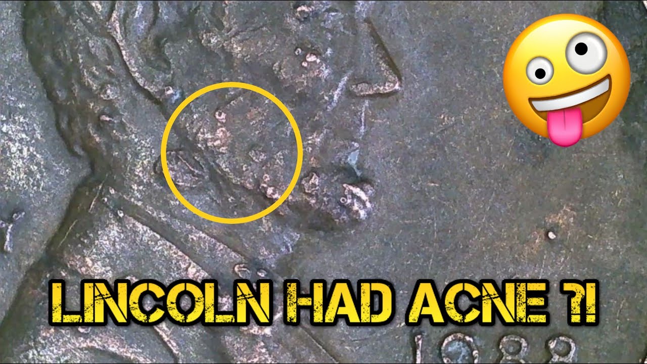 Coin Roll Hunting - Penny Hunt #2 - Tom:  Lincoln had acne?!