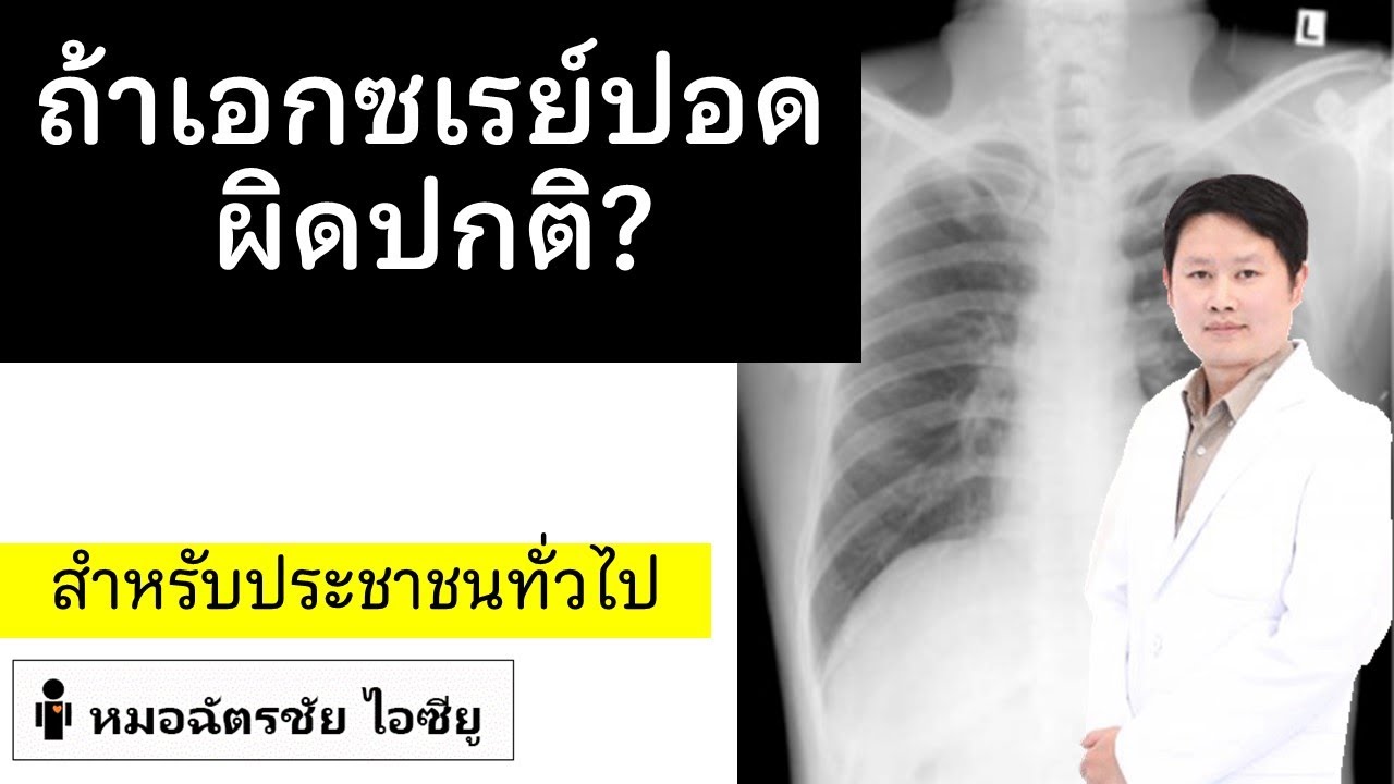 เอกซเรย์ปอดผิดปกติ เจอก้อน จุด ฝ้า : abnormal chest xray  ต้องทำอย่างไร