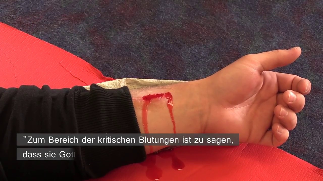 Erste Hilfe: So stillt man eine Blutung