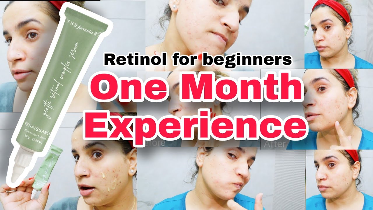New to Retinol? Try This Gentle Formularx Retinol Serum | Honest Review