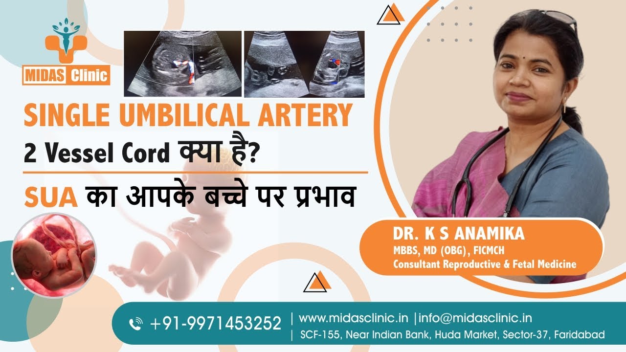 SINGLE UMBILICAL ARTERY | 2 Vessel Cord क्या है? | SUA का आपके बच्चे पर प्रभाव