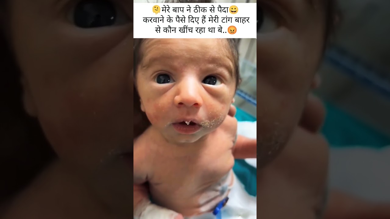 #hospital #doctor #nursing #baby #joke #trending #viral #reel #shorts #vigo #cannula #icu #nicu