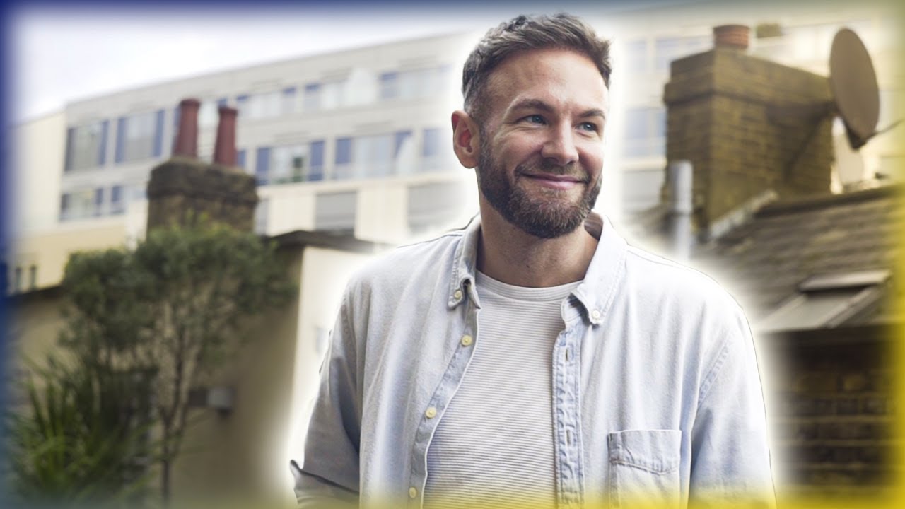 Chris' FUE Hair Transplant Result in London | Westminster Medical Group