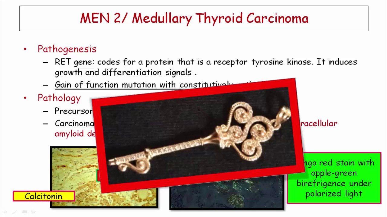 12DaysinMarch, Adrenal Medulla и MEN2 для USMLE Step One