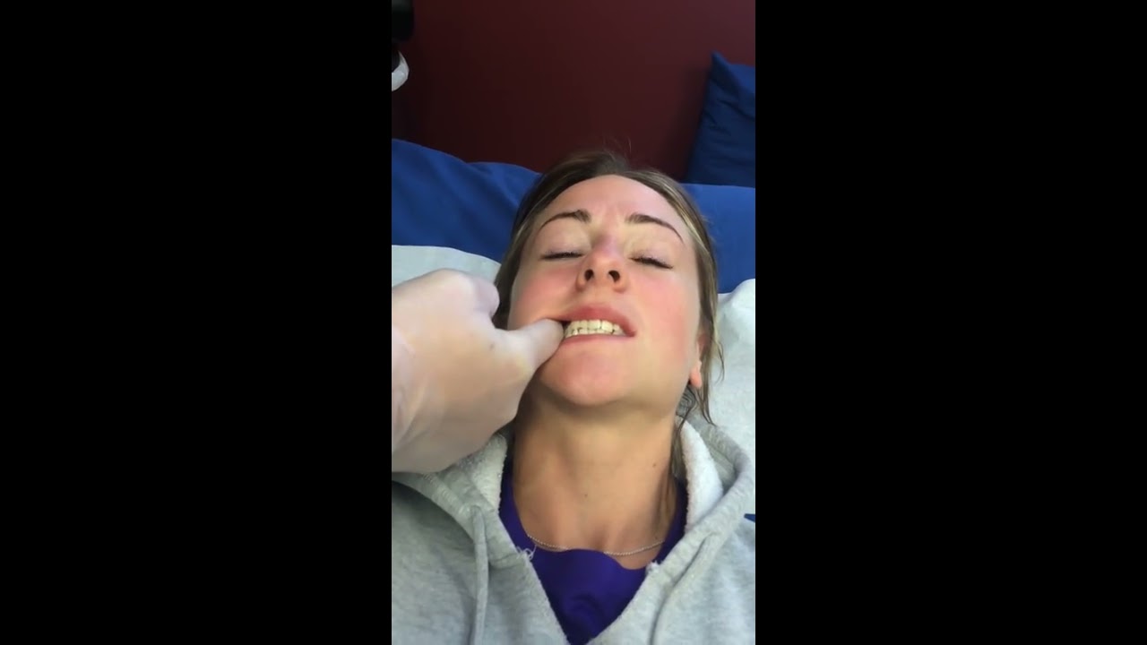Treatment of TMJ Disorder in 5 mins demonstrates by Dr. Lombardi DC www.dranthonylombardi.com
