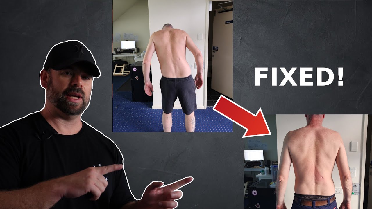 The Rehab Structure to Fix Back Pain for GOOD.