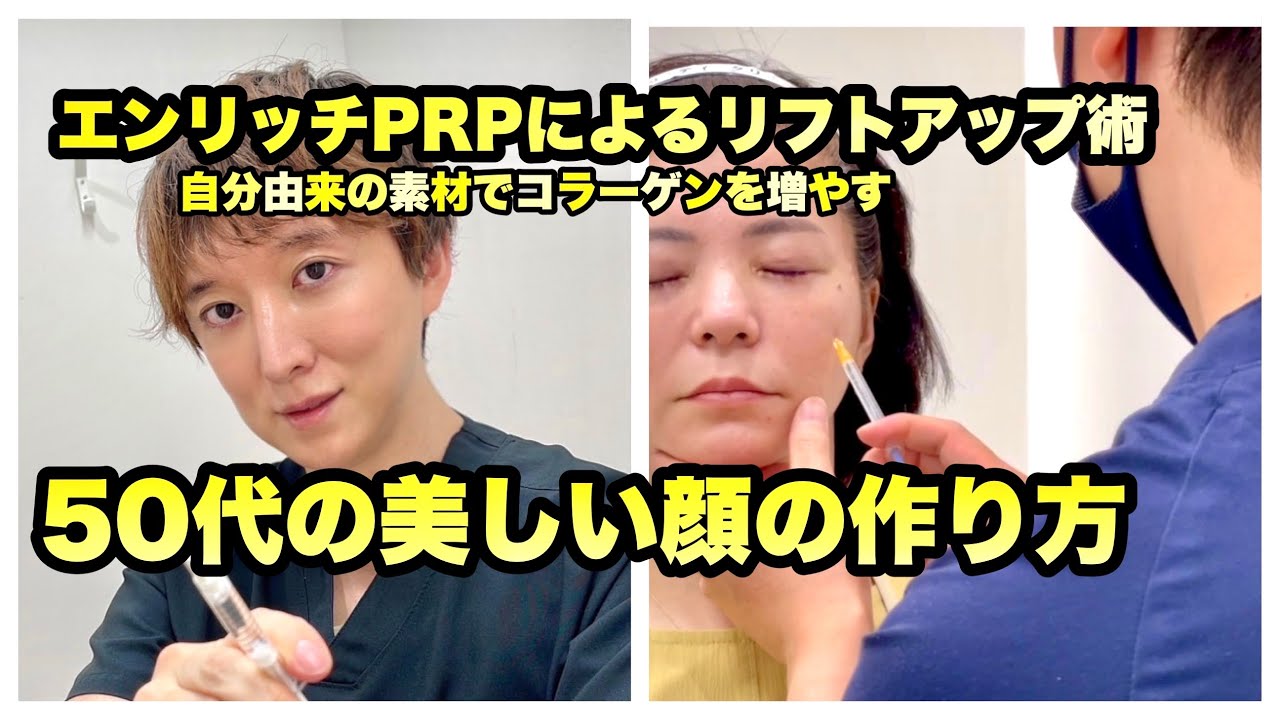 エンリッチPRPによるリフトアップ術。50代の美しい顔の作り方。