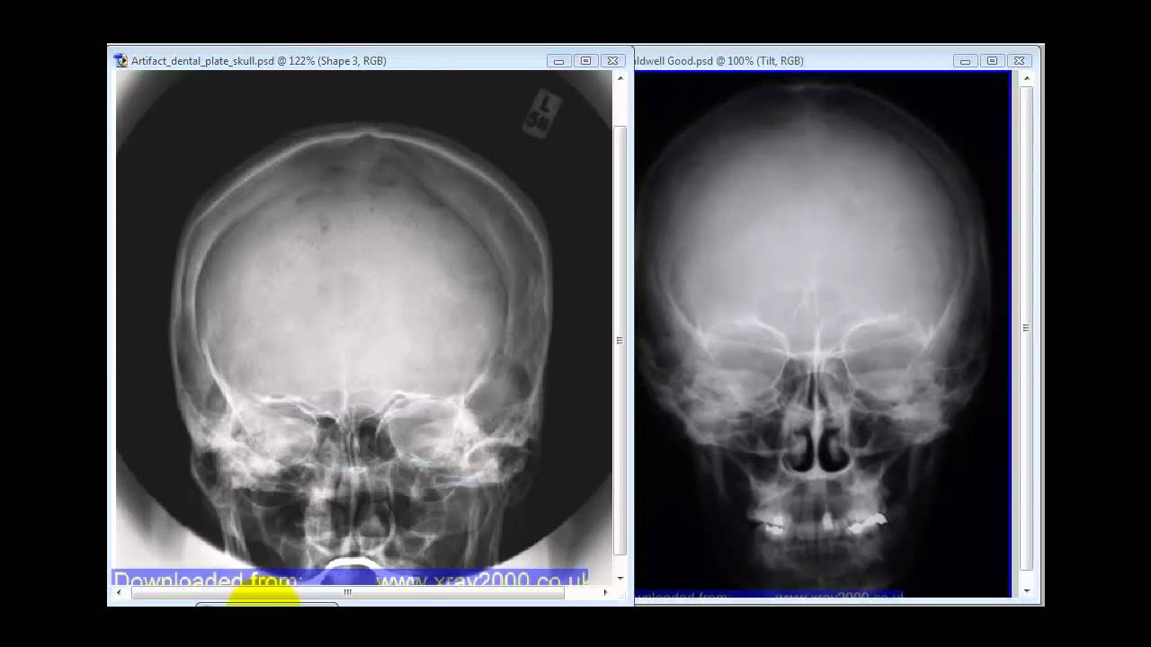 PA Caldwell Skull (HD)