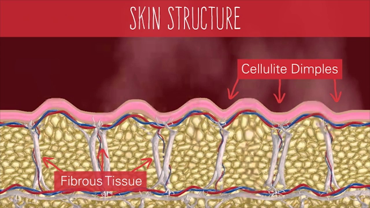 How Cellfina Works