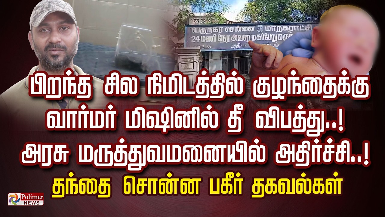 பிறந்த சில நிமிடத்தில் குழந்தைக்கு வார்மர் மிஷினில் தீ விபத்து..! அரசு மருத்துவமனையில் அதிர்ச்சி..!