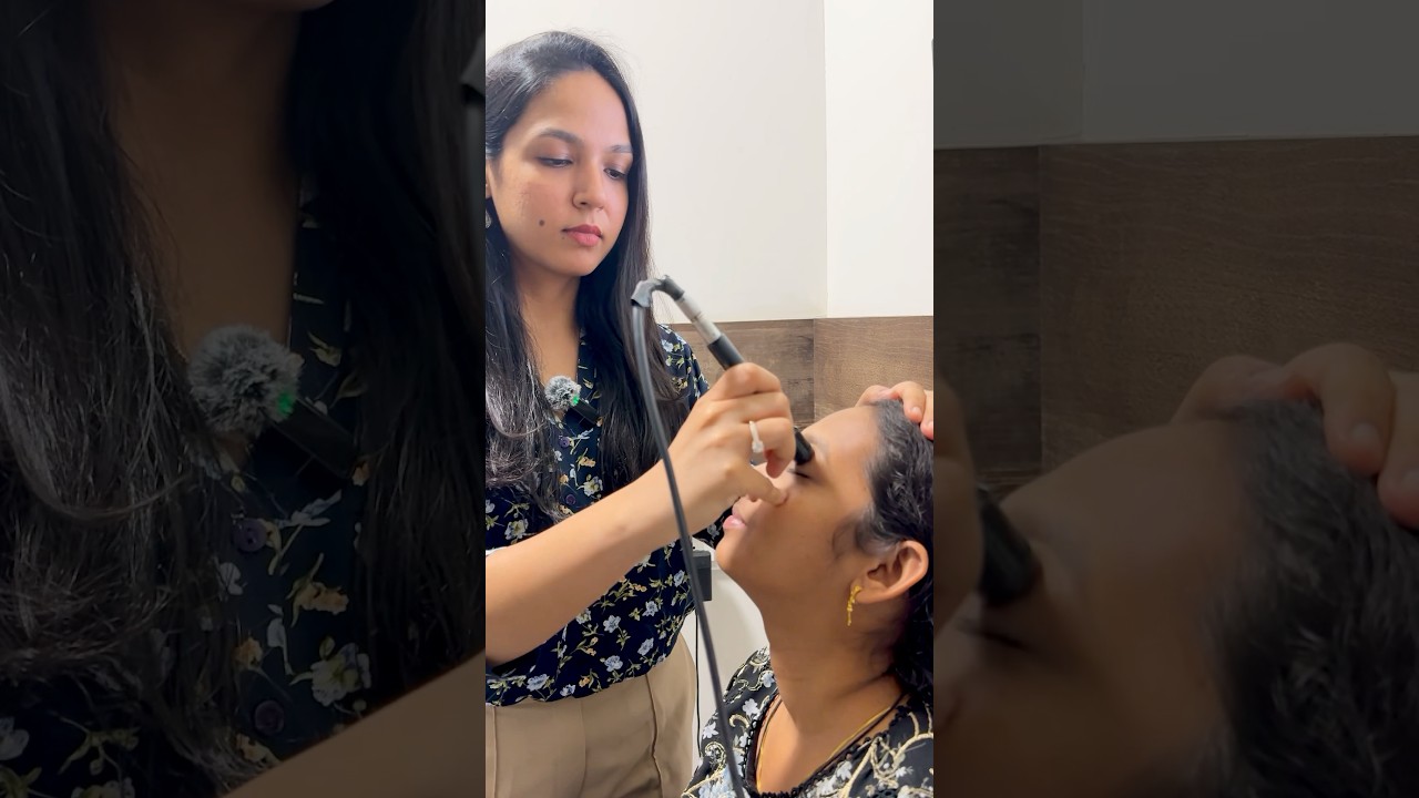 What is B-Scan Ultrasound? | Advanced Eye Diagnostic Explained #eyes #ultrasound #eyehealth