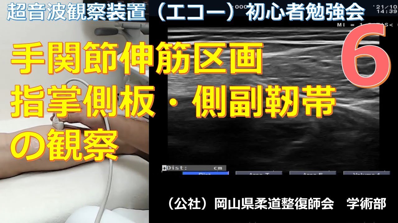 第6回　超音波観察装置初心者勉強会　手関節伸筋区画指掌側板・側副靭帯の観察