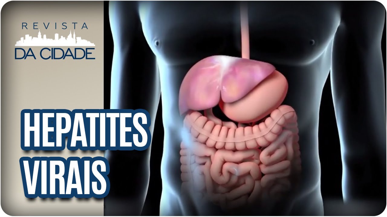 Hepatites Virais: Tipos, Sintomas, Causas, Tratamentos - Revista da Cidade (26/07/2017)