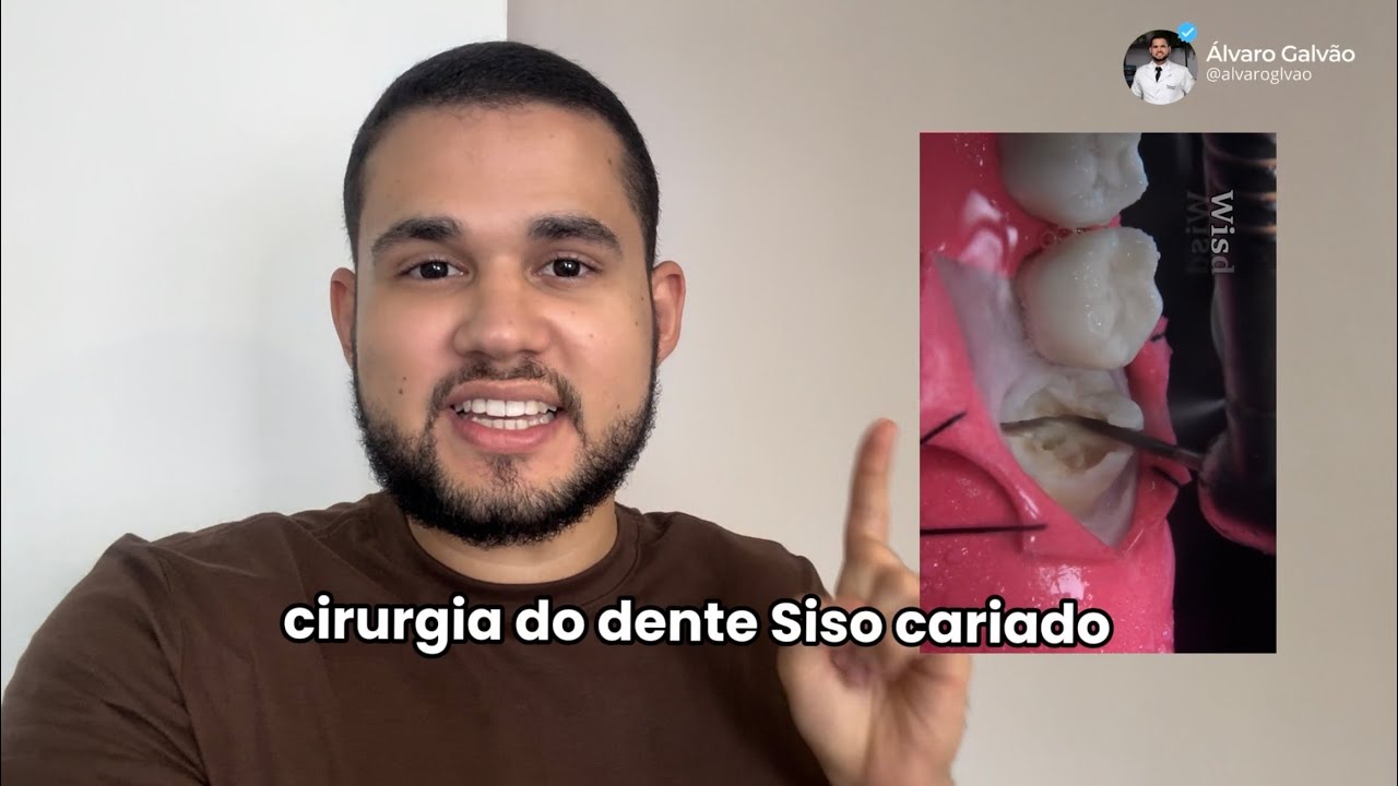 Cirurgia do dente Siso Cariado